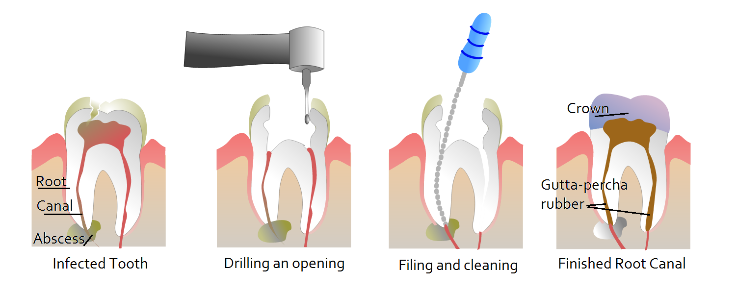 Dentalia smiles